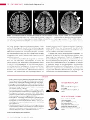 Vorschauseite 3: Kortikobasale Degeneration