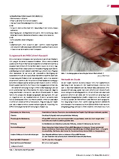 Vorschauseite 2: MIS-C versus Kawasaki Überlappende klinische Symptomatik erschwert die Abgrenzung der beiden hochfieberhaften Syndrome