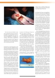 Vorschauseite 4: Operative Therapie des Lymphödems