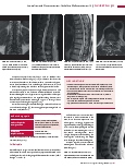 Vorschauseite 2: Anomalien und Normvarianten: Vaskuläre Malformationen 1.5 Intramedulläres Hämangiom
