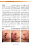 Vorschauseite 3: Hypnose, der Einfluss der Psyche und die transdisziplinäre Zusammenarbeit auf äußere und innere Wunden