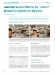 Vorschauseite 1: Anästhesieverfahren bei einem femoropoplitealen Bypass