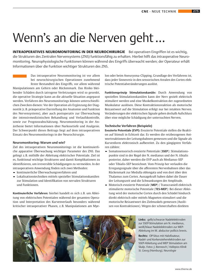 Vorschauseite 1: Wenn’s an die Nerven geht …