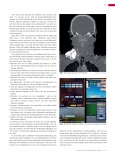 Vorschauseite 2: Paravasat in der radiologischen Diagnostik. Was ist ein Paravasat bezogen auf die Radiologie?