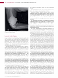 Vorschauseite 3: Paravasat in der radiologischen Diagnostik. Was ist ein Paravasat bezogen auf die Radiologie?