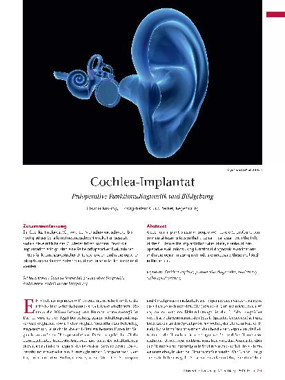 Vorschauseite 1: Cochlea-Implantat Präoperative Funktionsdiagnostik und Bildgebung