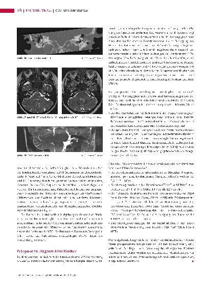 Vorschauseite 6: Cochlea-Implantat Präoperative Funktionsdiagnostik und Bildgebung