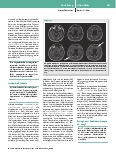 Vorschauseite 4: Perioperative Organdysfunktionen und Outcome – das Endothel im Fokus