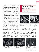 Vorschauseite 2: Anomalien und Normvarianten - Interne Veränderungen 2. 21: Nierenzysten und zystische Nierendegeneration