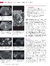 Vorschauseite 3: Anomalien und Normvarianten - Interne Veränderungen 2. 21: Nierenzysten und zystische Nierendegeneration
