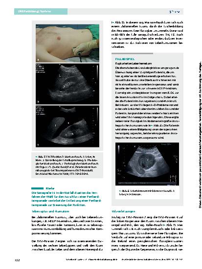 Vorschauseite 5: Abdominelle Notfallsonografie in der Intensiv- und Akutmedizin