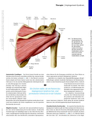 Vorschauseite 2: Wenn es in der Schulter klemmt – Impingement-Syndrom