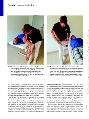 Vorschauseite 3: Wenn es in der Schulter klemmt – Impingement-Syndrom