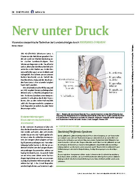 Vorschauseite 1: Nerv unter Druck