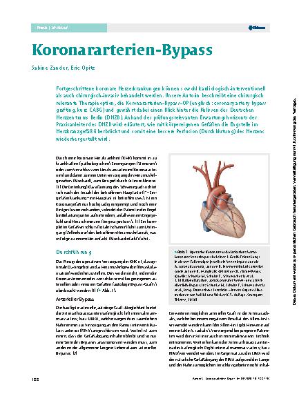 Vorschauseite 1: Koronararterien-Bypass