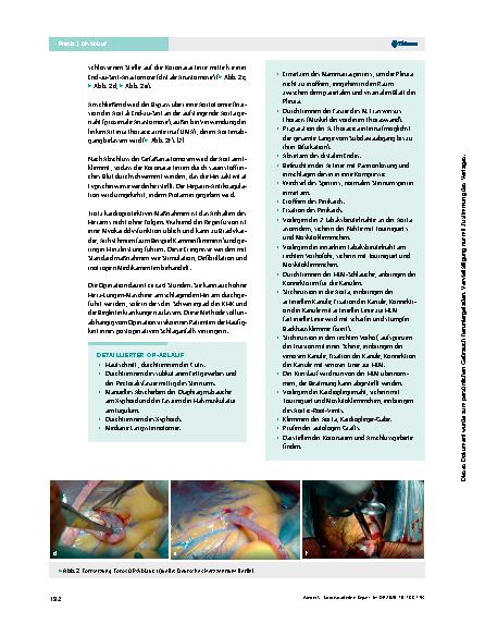 Vorschauseite 5: Koronararterien-Bypass