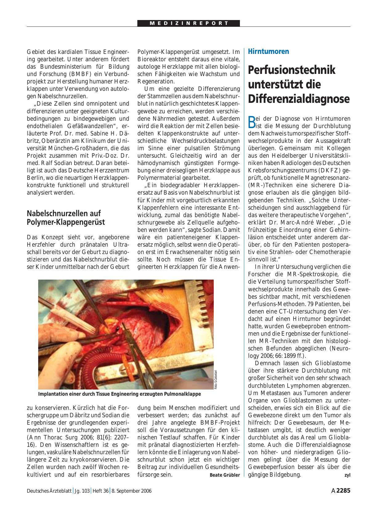 Vorschauseite 1: Hirntumoren: Perfusionstechnik unterstützt die Differenzialdiagnose