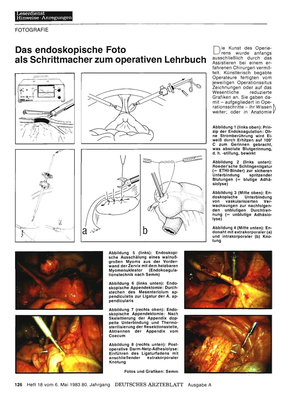 Vorschauseite 1: Das endoskopische Foto als Schrittmacher zum operativen Lehrbuch
