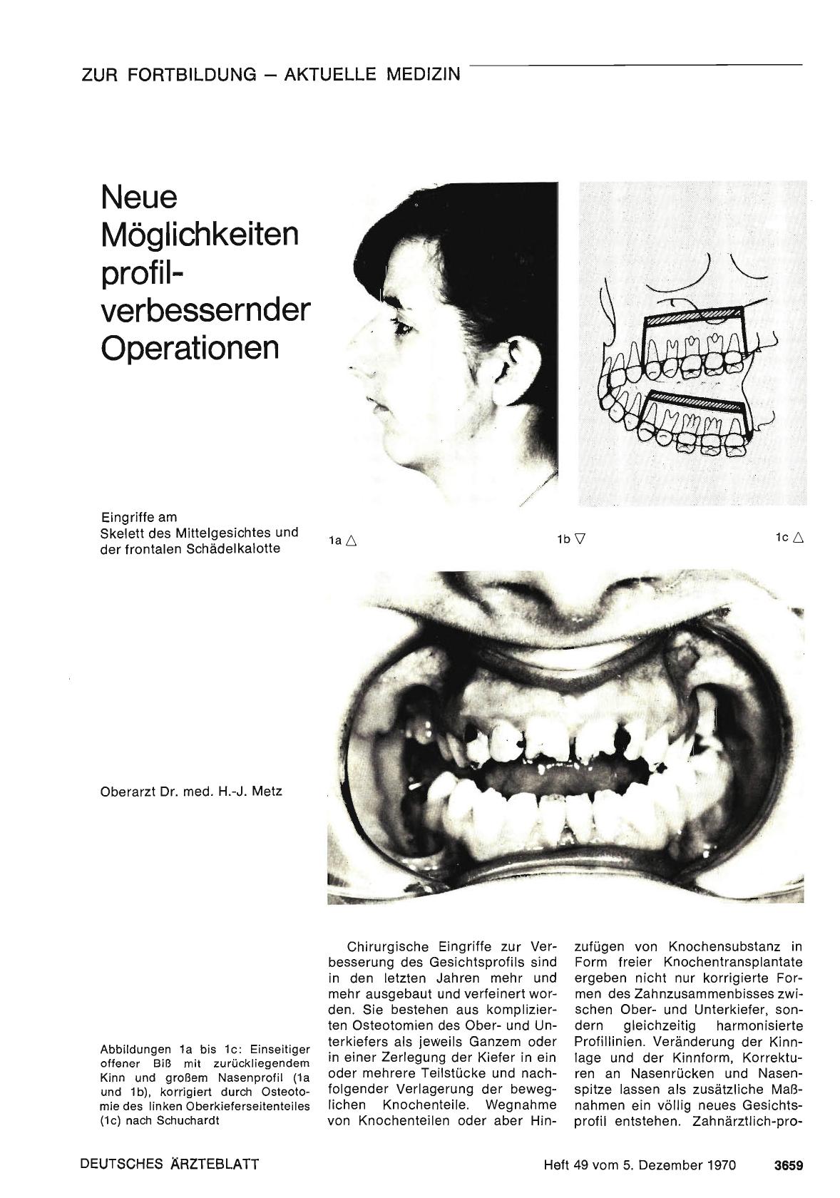 Vorschauseite 1: Neue Möglichkeiten profilverbessernder Operationen