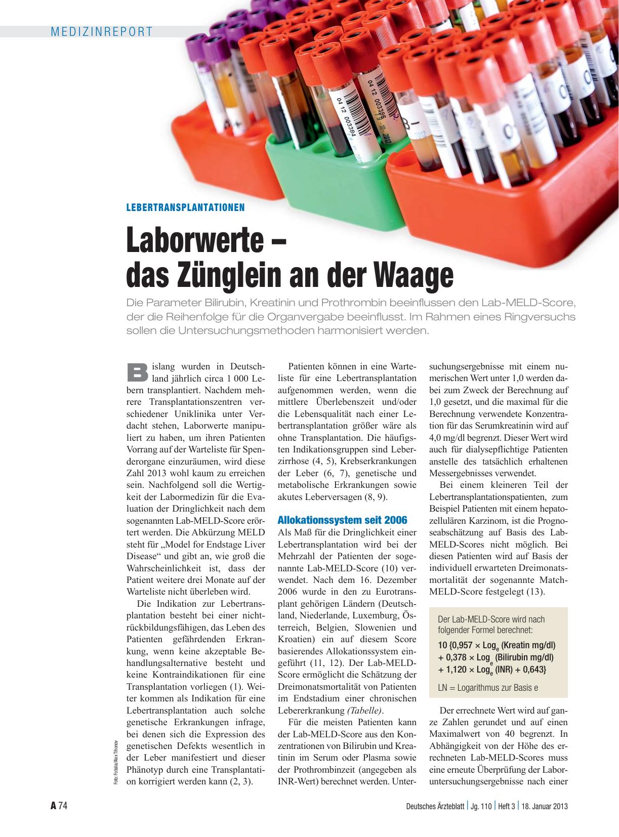 Vorschauseite 1: Lebertransplantationen: Laborwerte – das Zünglein an der Waage
