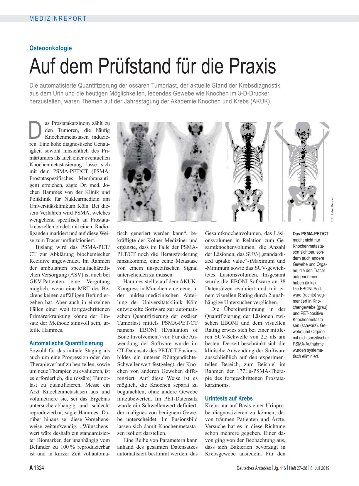 Vorschauseite 1: Osteoonkologie: Auf dem Prüfstand für die Praxis