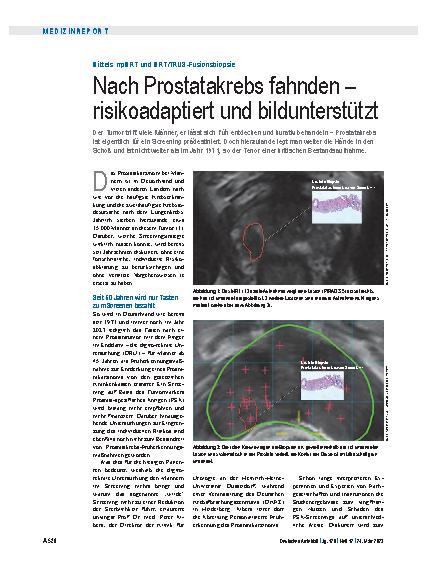 Vorschauseite 1: Mittels mpMRT und MRT/TRUS-Fusionsbiopsie: Nach Prostatakrebs fahnden – risikoadaptiert und bildunterstützt