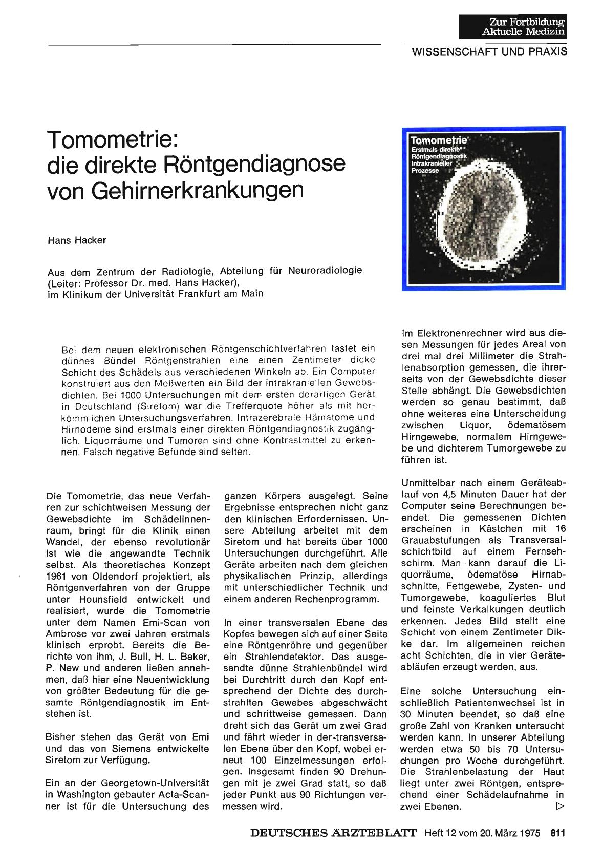 Vorschauseite 1: Tomometrie: die direkte Röntgendiagnose von Gehirnerkrankungen