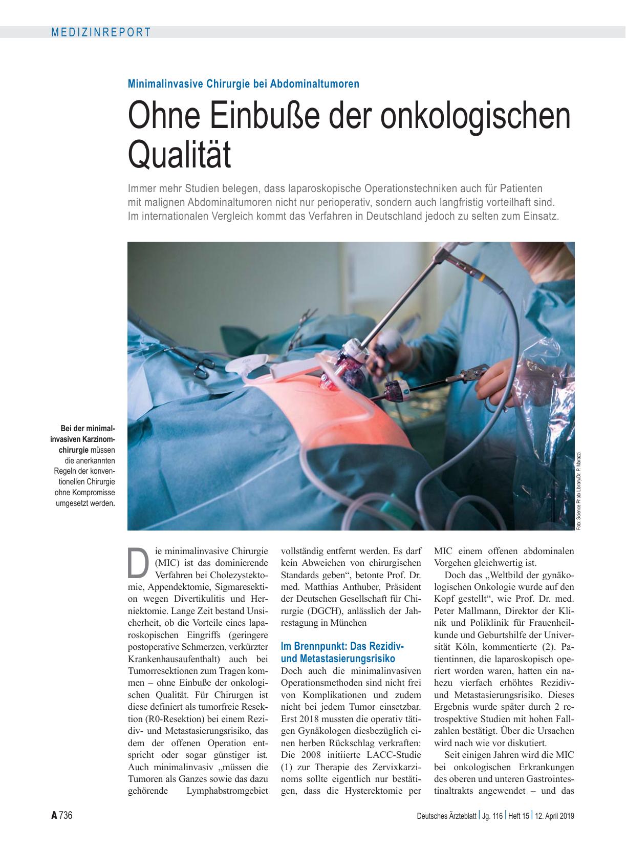 Vorschauseite 1: Minimalinvasive Chirurgie bei Abdominaltumoren: Ohne Einbuße der onkologischen Qualität