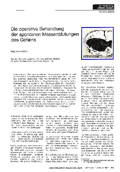 Vorschauseite 1: Die operative Behandlung der spontanen Massenblutungen des Gehirns