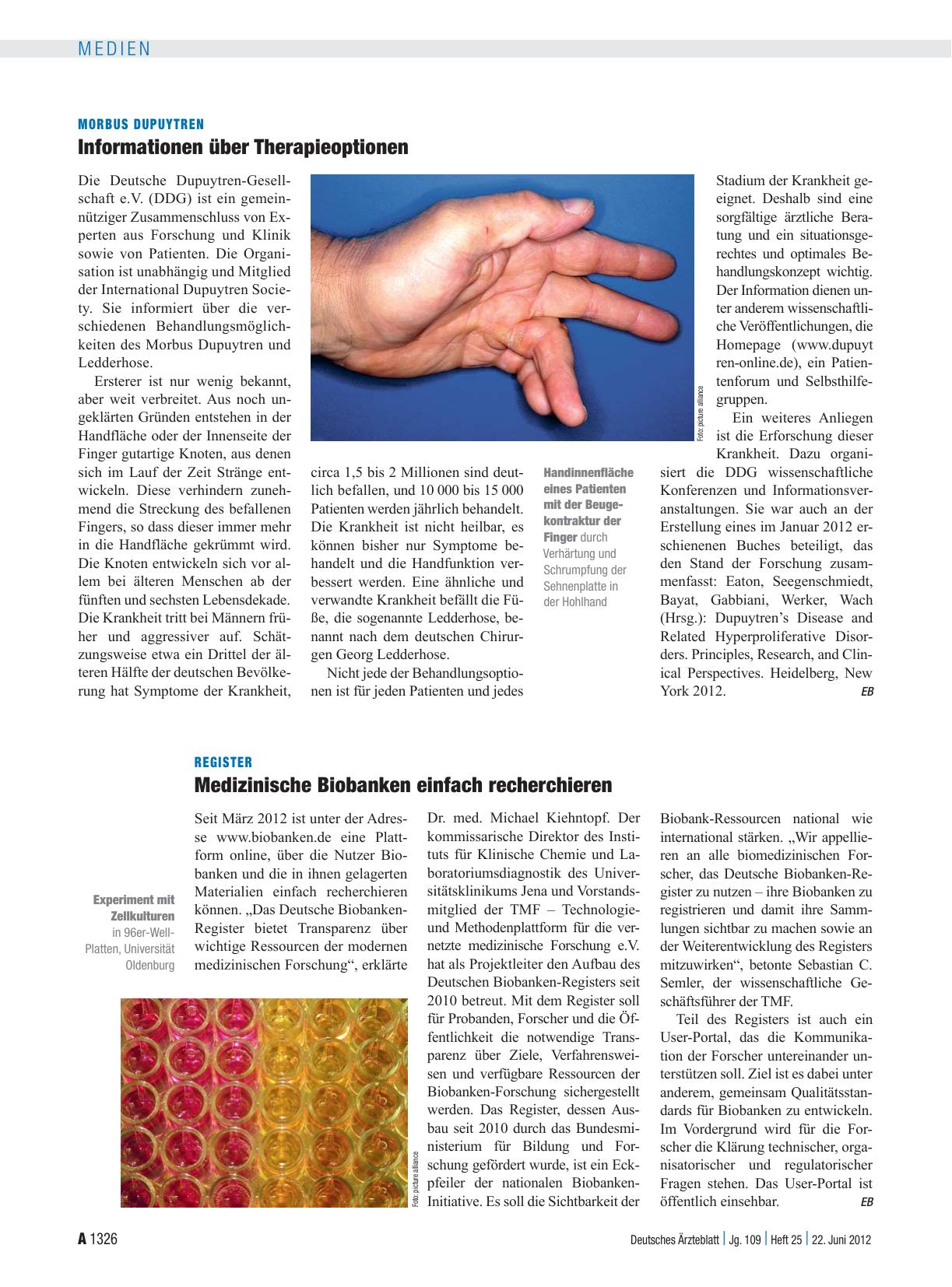 Vorschauseite 1: Morbus Dupuytren: Informationen über Therapieoptionen
