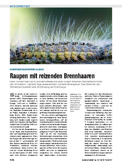 Vorschauseite 1: Eichenprozessionsspinner-Allergie: Raupen mit reizenden Brennhaaren