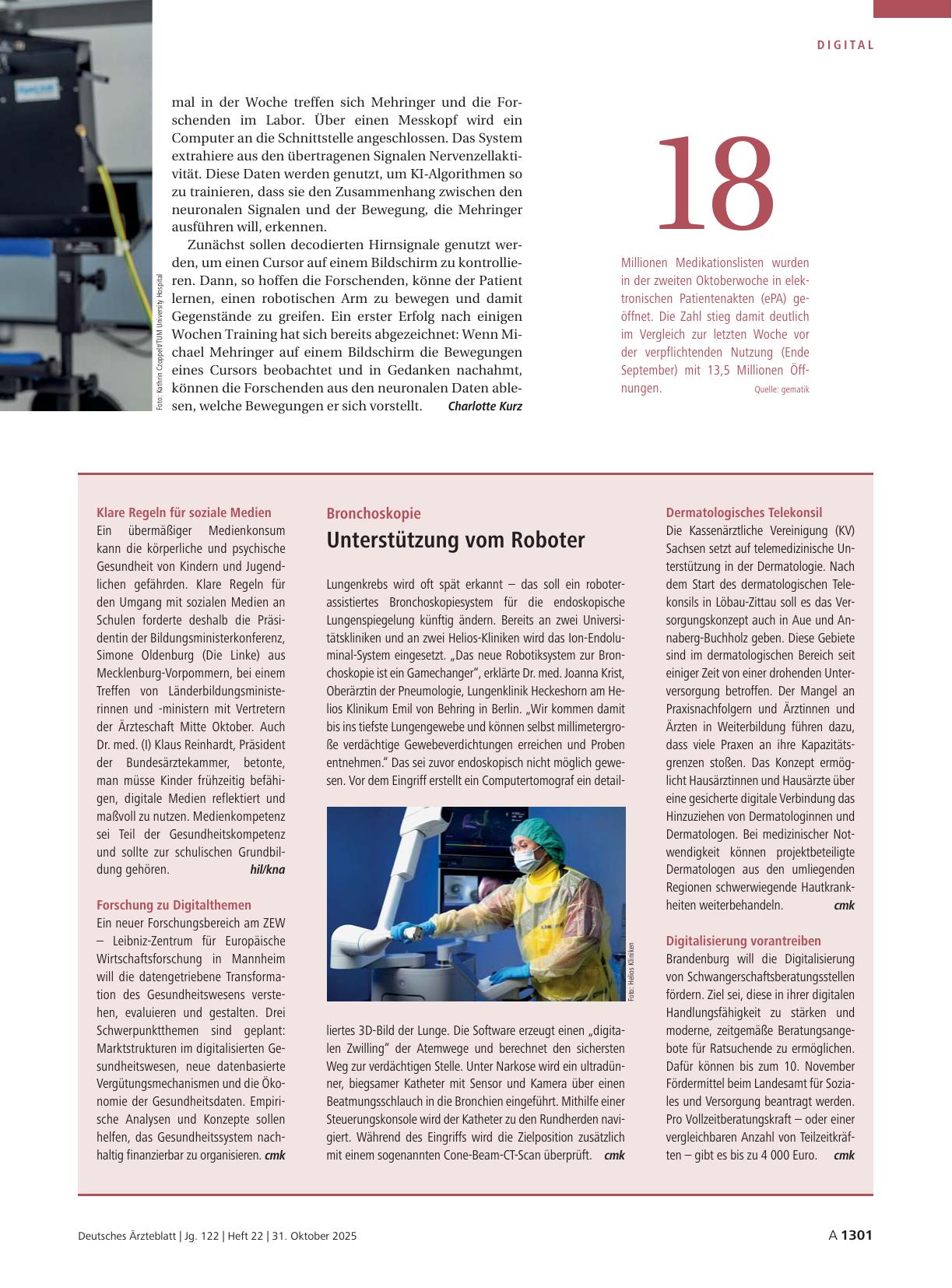 Vorschauseite 1: Bronchoskopie: Unterstützung vom Roboter