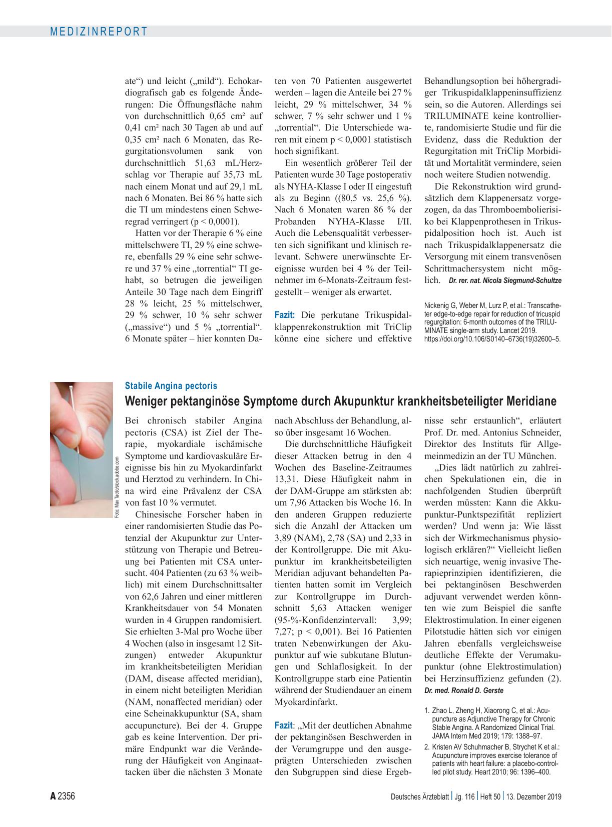 Vorschauseite 1: Stabile Angina pectoris: Weniger pektanginöse Symptome durch Akupunktur krankheitsbeteiligter Meridiane