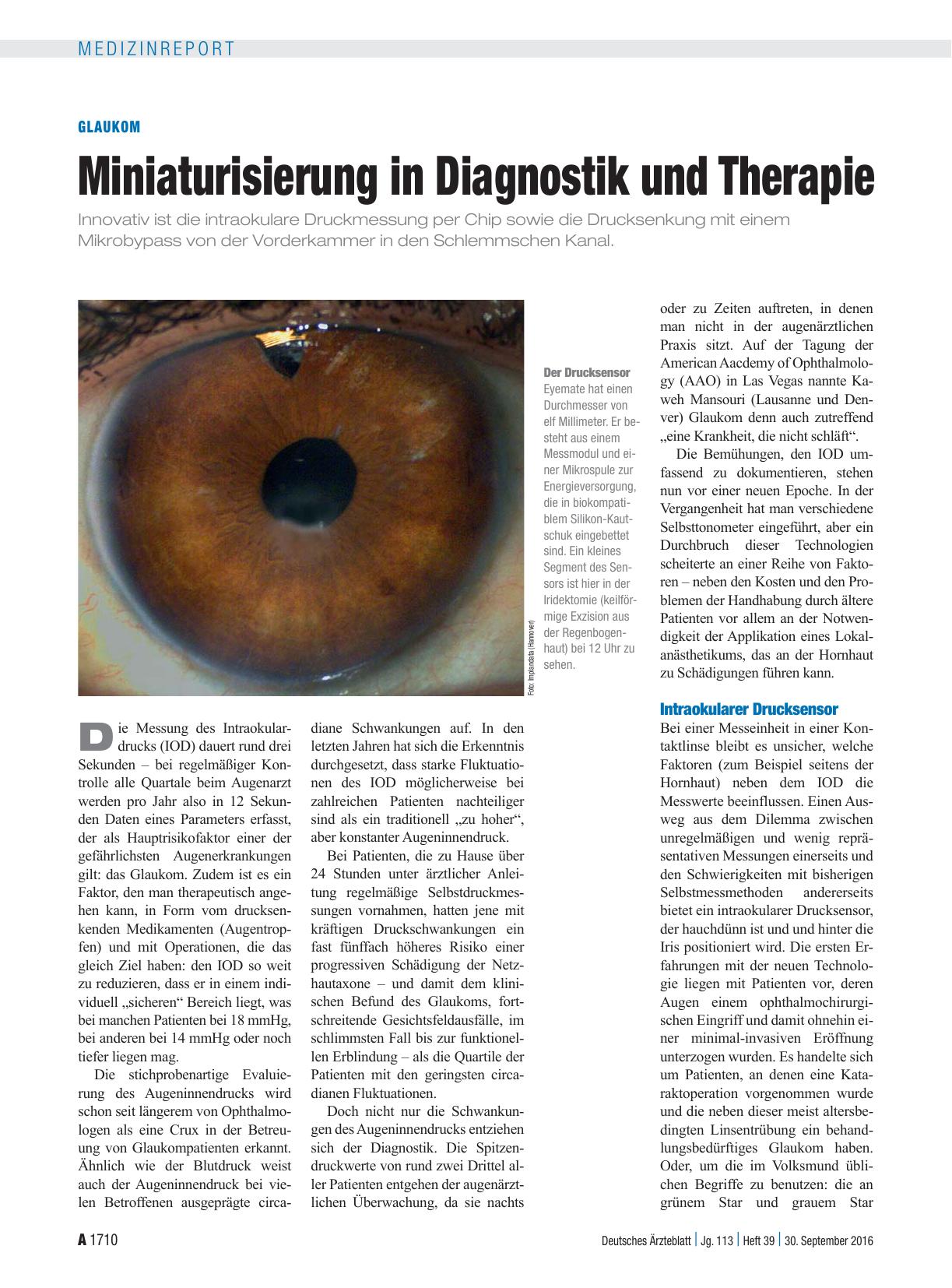 Vorschauseite 1: Glaukom: Miniaturisierung in Diagnostik und Therapie