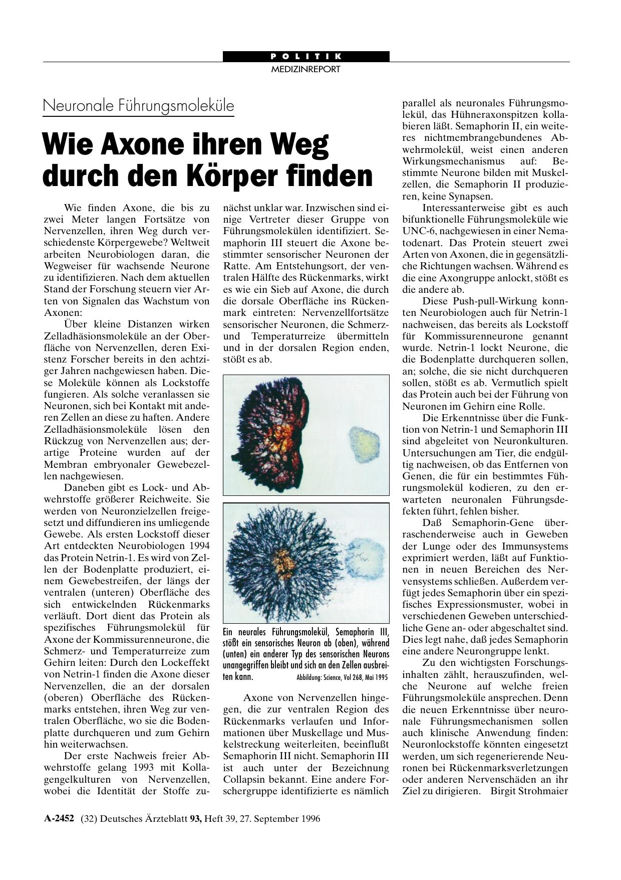 Vorschauseite 1: Neuronale Führungsmoleküle: Wie Axone ihren Weg durch den Körper finden
