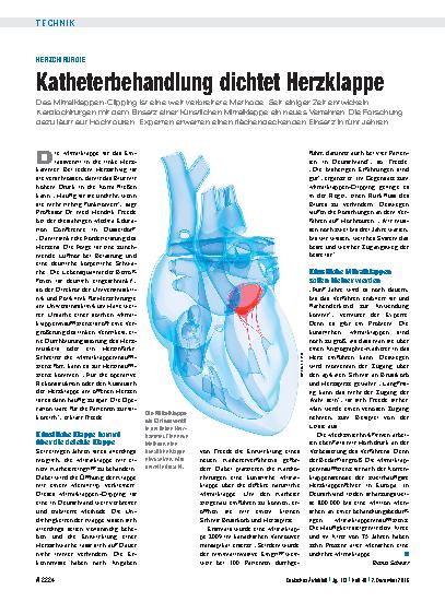 Vorschauseite 1: Herzchirurgie: Katheterbehandlung dichtet Herzklappe