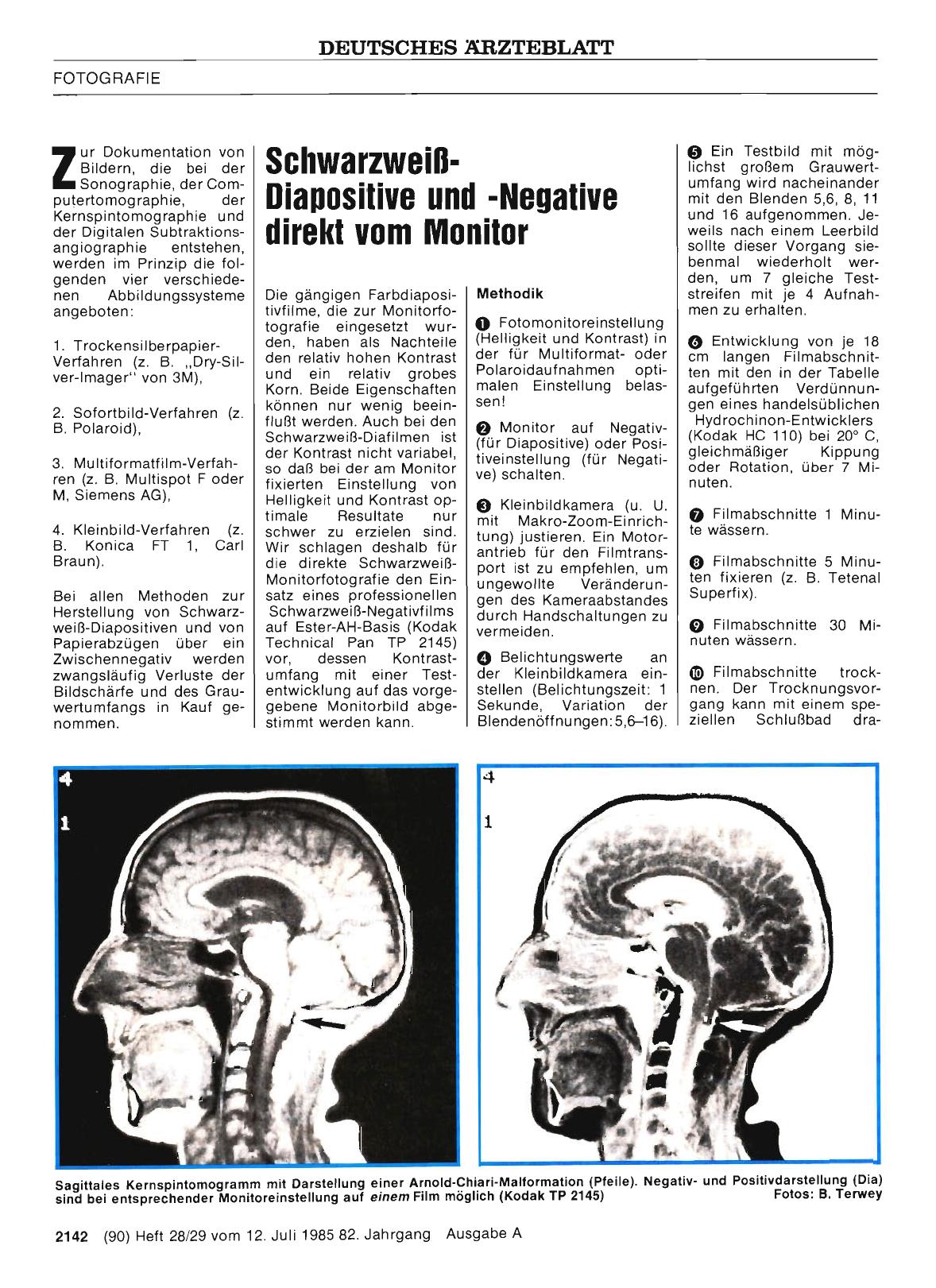Vorschauseite 1: Schwarzweiß-Diapositive und -Negative direkt vom Monitor