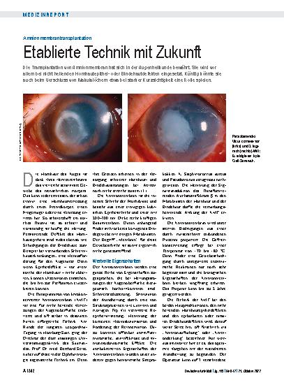 Vorschauseite 1: Amnionmembrantransplantation: Etablierte Technik mit Zukunft