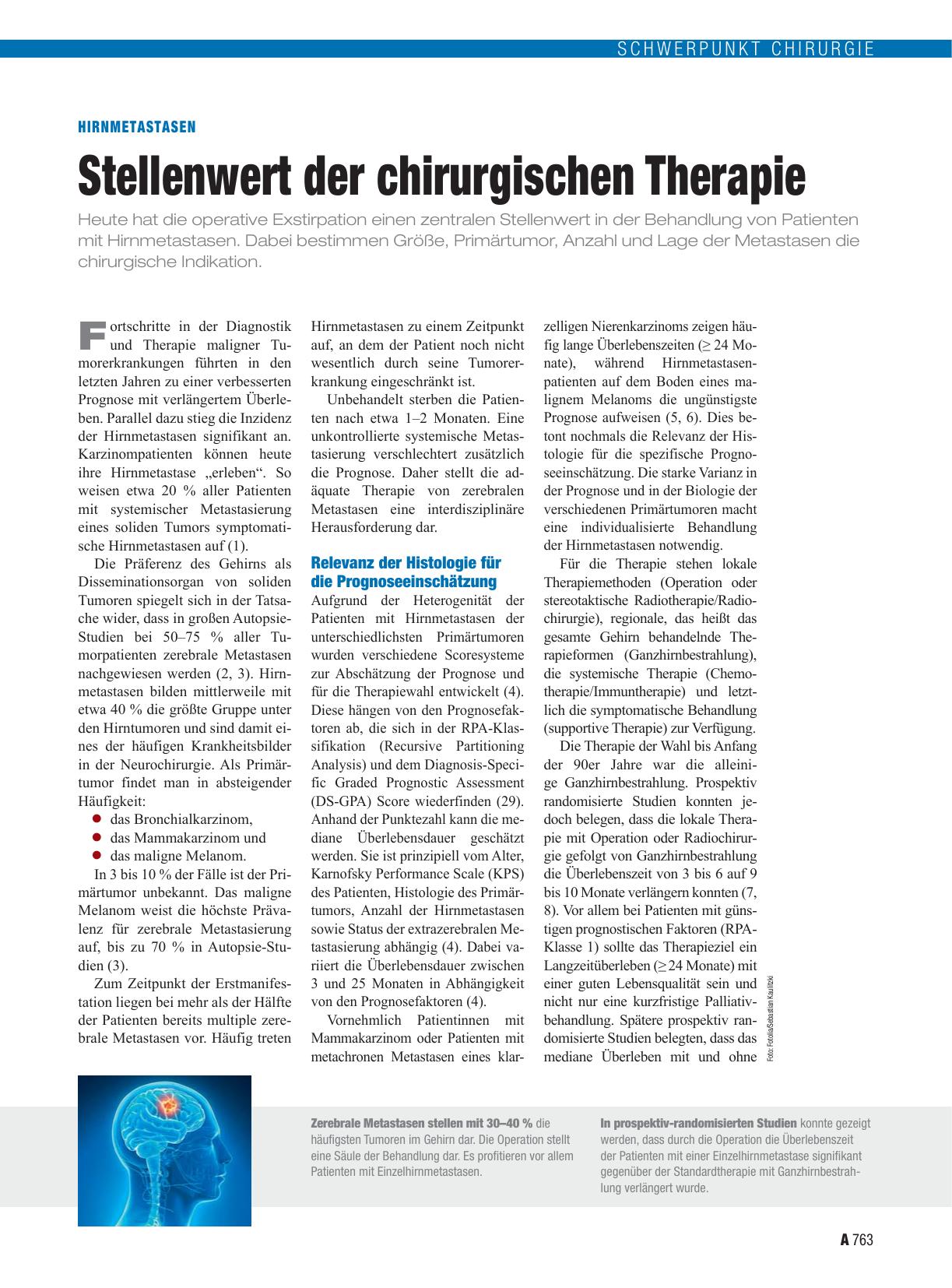 Vorschauseite 1: Hirnmetastasen: Stellenwert der chirurgischen Therapie