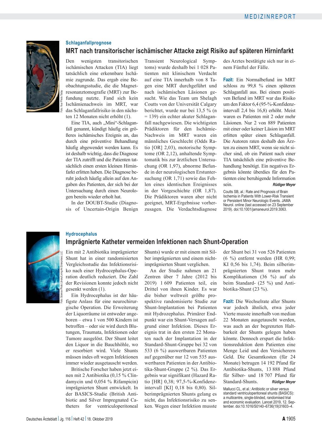 Vorschauseite 1: Hydrocephalus: Imprägnierte Katheter vermeiden Infektionen nach Shunt-Operation