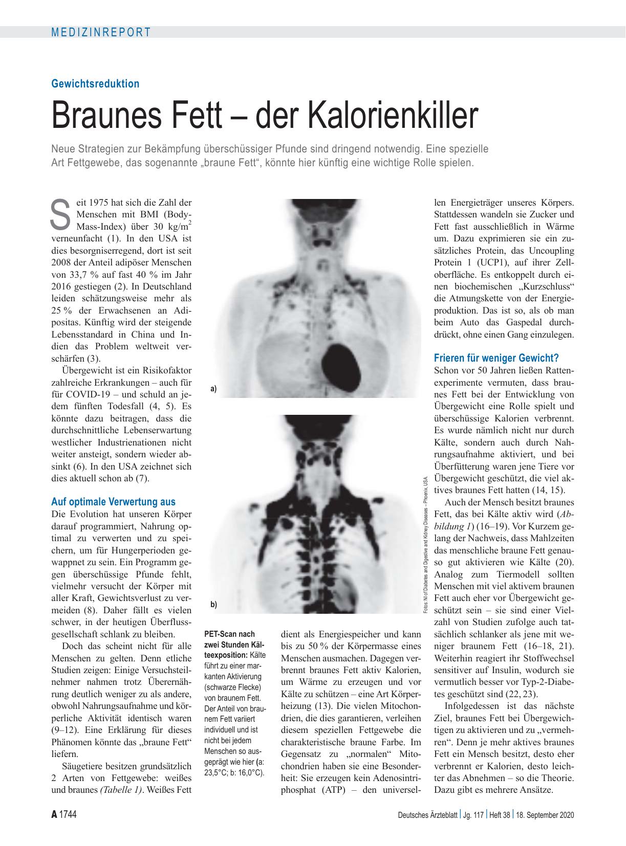 Vorschauseite 1: Gewichtsreduktion: Braunes Fett – der Kalorienkiller