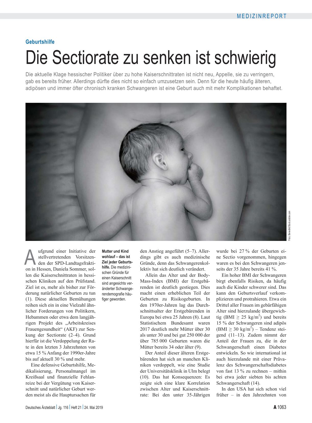 Vorschauseite 1: Geburtshilfe: Die Sectiorate zu senken ist schwierig