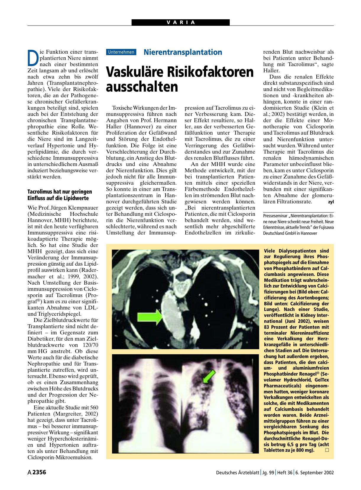 Vorschauseite 1: Nierentransplantation: Vaskuläre Risikofaktoren ausschalten