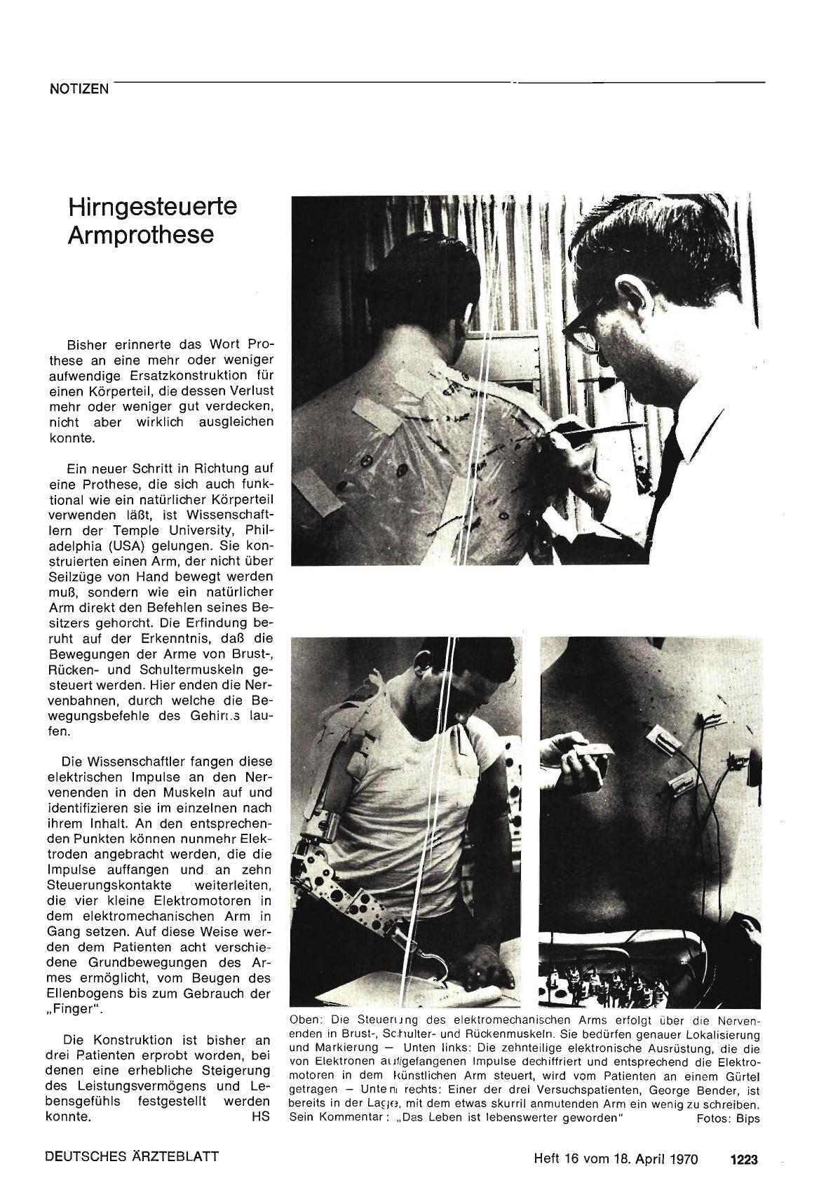 Vorschauseite 1: Hirngesteuerte Armprothese