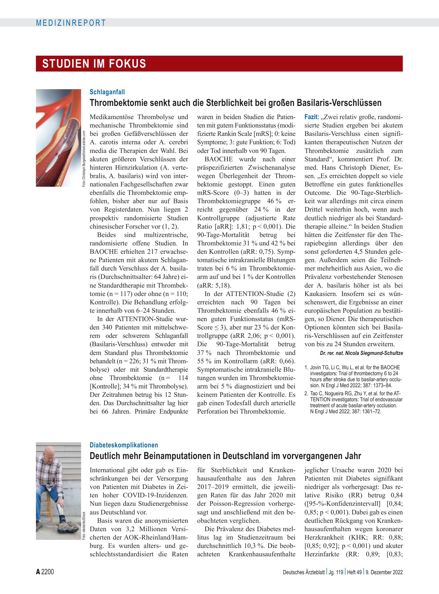 Vorschauseite 1: Schlaganfall: Thrombektomie senkt auch die Sterblichkeit bei großen Basilaris-Verschlüssen – Deutsches Ärzteblatt