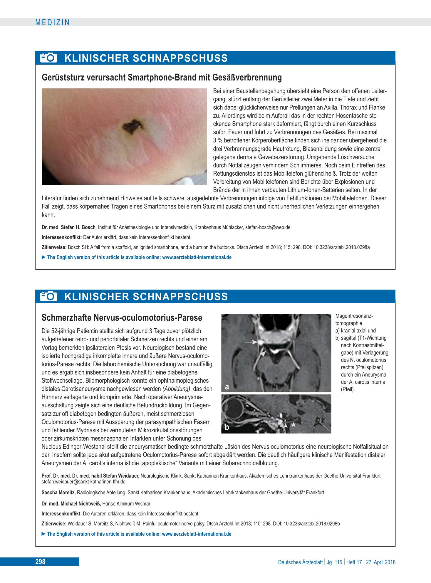 Vorschauseite 1: Schmerzhafte Nervus-oculomotorius-Parese – Deutsches Ärzteblatt