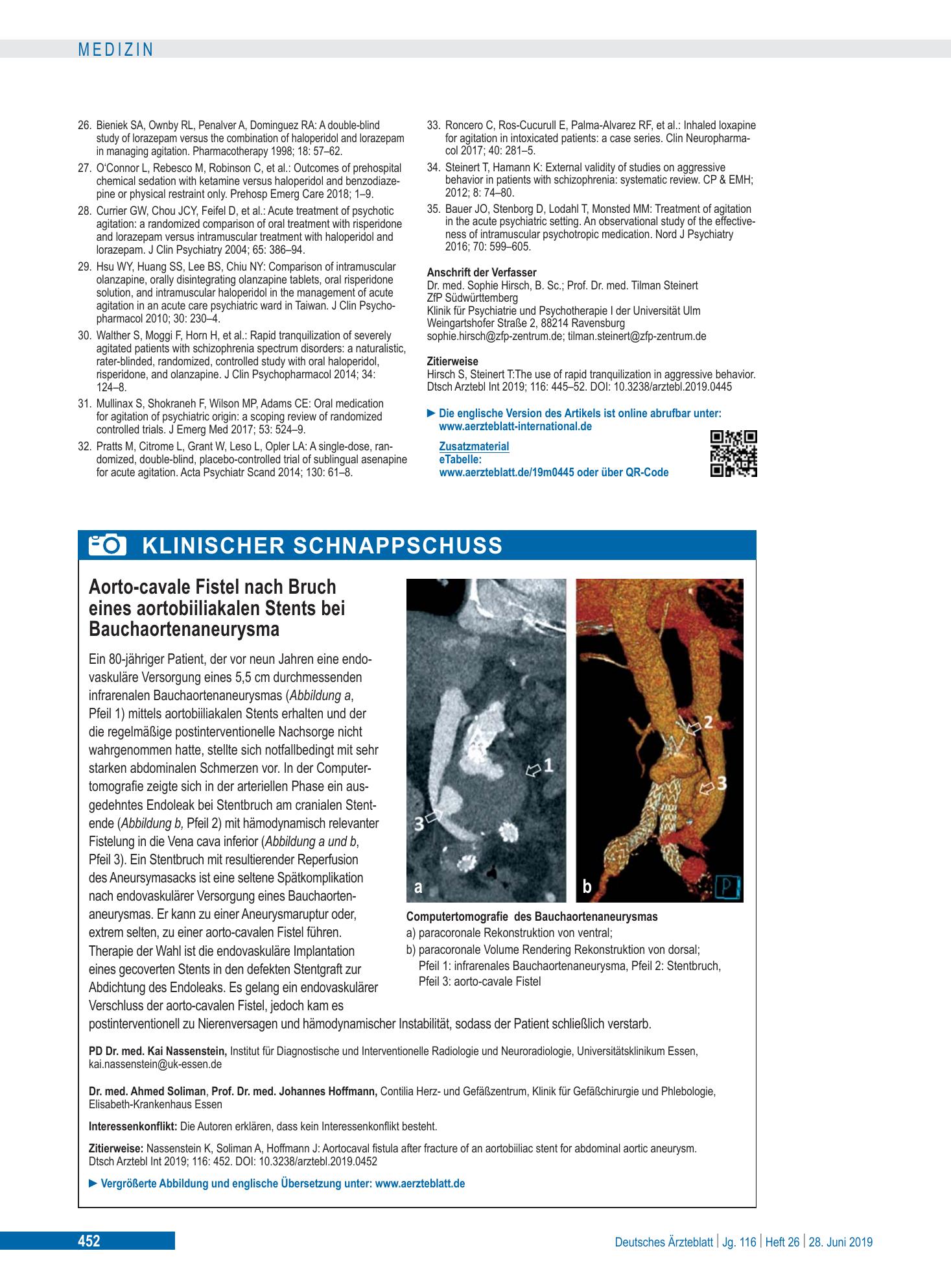 Vorschauseite 1: Aorto-cavale Fistel nach Bruch eines aortobiiliakalen Stents bei Bauchaortenaneurysma – Deutsches Ärzteblatt