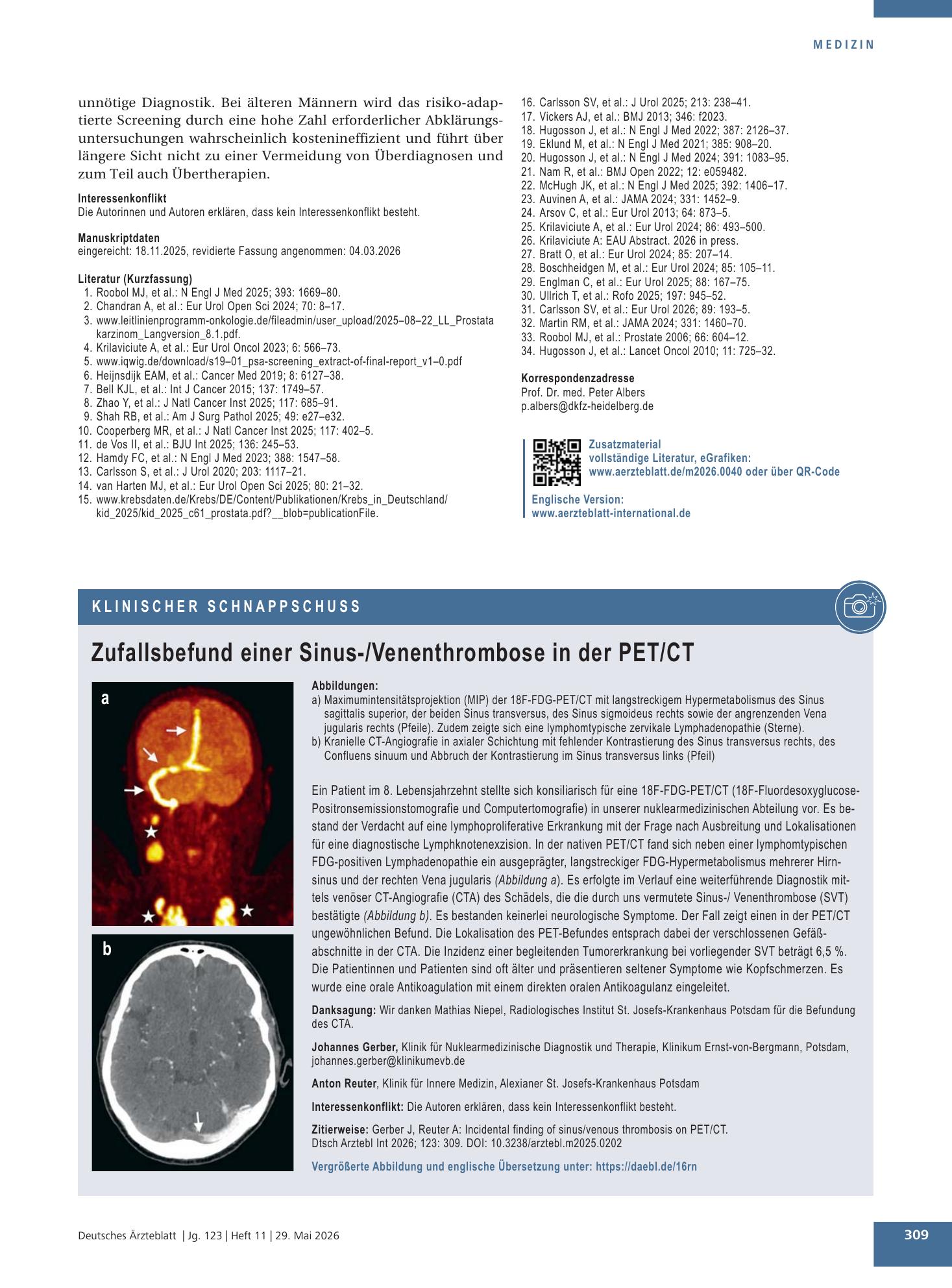 Vorschauseite 1: Zufallsbefund einer Sinus-/Venenthrombose in der PET/CT – Deutsches Ärzteblatt