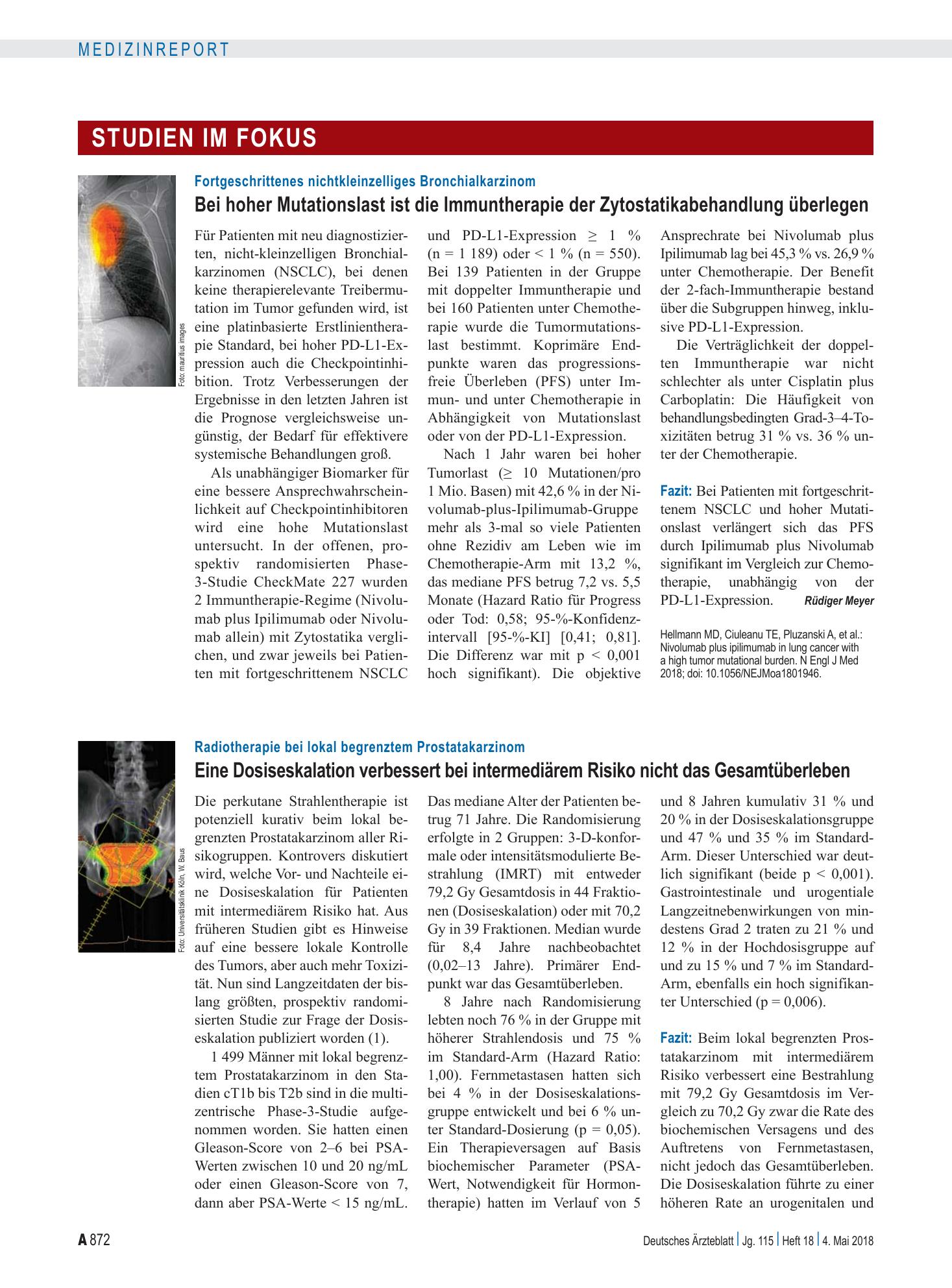 Vorschauseite 1: Radiotherapie bei lokal begrenztem Prostatakarzinom: Eine Dosiseskalation verbessert bei intermediärem Risiko nicht das Gesamtüberleben – Deutsches Ärzteblatt