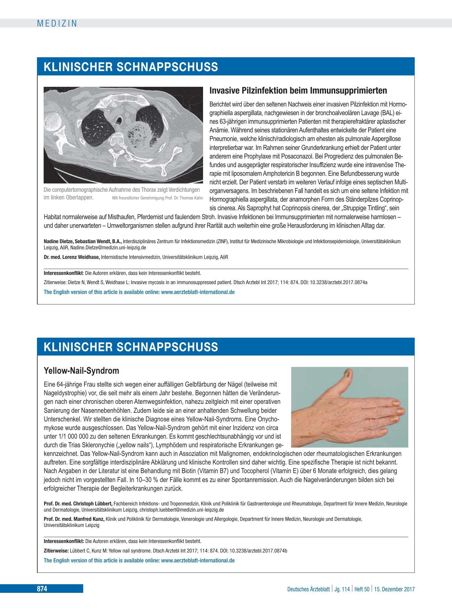 Vorschauseite 1: Yellow-Nail-Syndrom – Deutsches Ärzteblatt